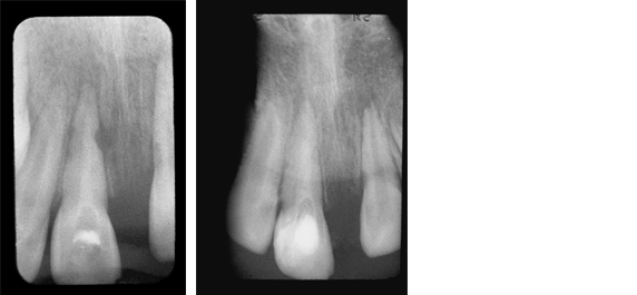 Hard-Tissue