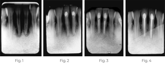 tempcanal page photos - 1